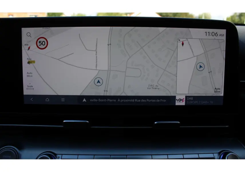 Écran tactile 12,3 pouces du Hyundai Kona 2024 affichant la navigation et la radio DAB.